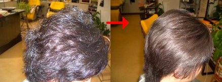この写真のような縮毛矯正をされていた97%の美容室は進化したシステム:マレーア・レナータ縮毛矯正施術へ転換しています。なおこの施術に用いたミコノスは既に廃盤になりました。