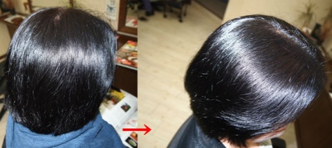 この写真のようなサプリカラーは進化したシステム:マレーア・レナータカラーへ転換しています。なおこの施術に用いたミコノスは既に廃盤になりました。