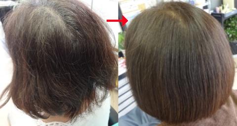 この写真のようなクイックストレート(トリートメント)をしていた97%の美容室は進化したシステム:マレーア・レナータストレートへ転換しています。なおこの施術に用いたミコノスは既に廃盤になりました。