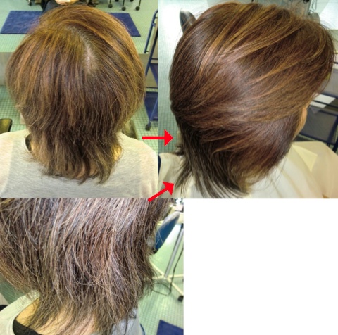 この写真のような施術をしていた97%の美容室は進化したシステム:マレーア・レナータ施術へ転換しています。なおこの施術に用いたミコノスは既に廃盤になりました。