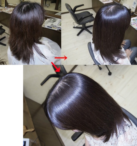 この写真のようなサプリカラーは進化したシステム:マレーア・レナータカラーへ転換しています。なおこの施術に用いたミコノスは既に廃盤になりました。