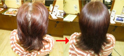 この写真のようなサプリカラーは進化したシステム:マレーア・レナータカラーへ転換しています。なおこの施術に用いたミコノスは既に廃盤になりました。