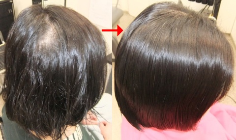 この写真のような縮毛矯正+カラー施術をされていた97%の美容室は進化したシステム:マレーア・レナータ縮毛矯正+カラー施術へ転換しています。なおこの施術に用いたミコノスは既に廃盤になりました。