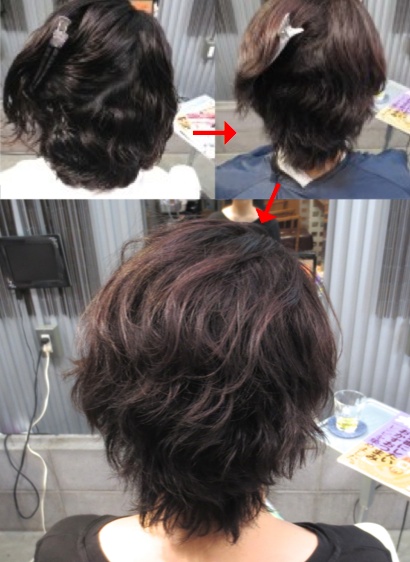 この写真のようなサプリカラーは進化したシステム:マレーア・レナータカラーへ転換しています。なおこの施術に用いたミコノスは既に廃盤になりました。