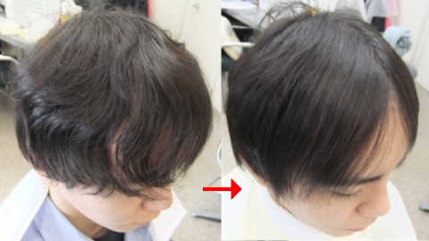 この写真のような縮毛矯正をされていた97%の美容室は進化したシステム:マレーア・レナータ縮毛矯正施術へ転換しています。なおこの施術に用いたミコノスは既に廃盤になりました。