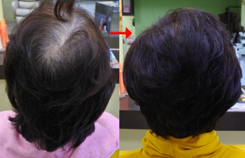 この写真はサプリカラーですが、90%以上の美容室は進化したシステム:マレーア・レナータカラーへ転換しています。なおこの施術に用いたミコノスは既に廃盤となっています。